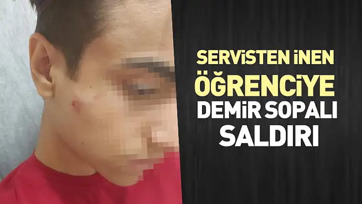 Servisten İnen Öğrenciye Demir Sopalı Saldırı