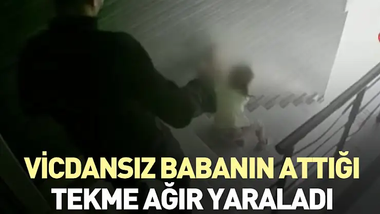 Vicdansız babanın attığı tekme ağır yaraladı