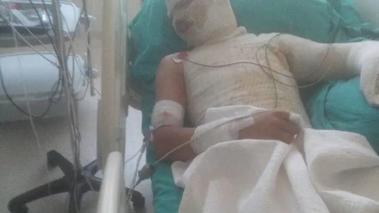 Yeğenini yakan amca, suçu ağabeyine attı