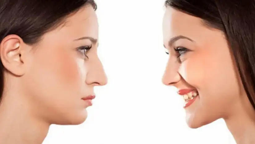 Yüz Şekillendirmede Çene Hattının Önemi Nedir?