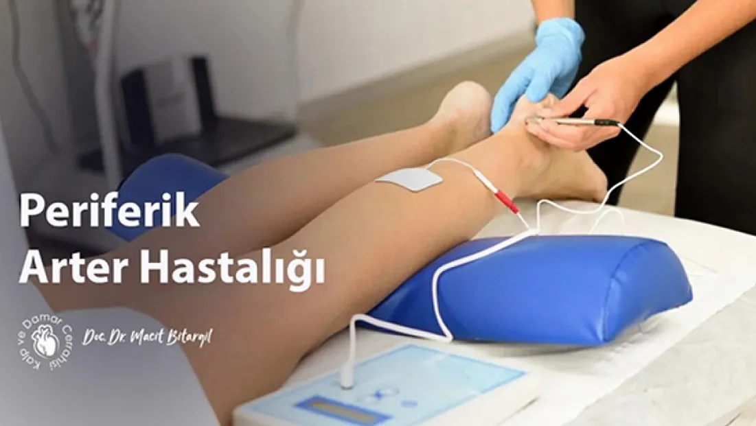Dolaşım Sisteminde Kritik Bir Tablo: Periferik Arter Hastalıkları