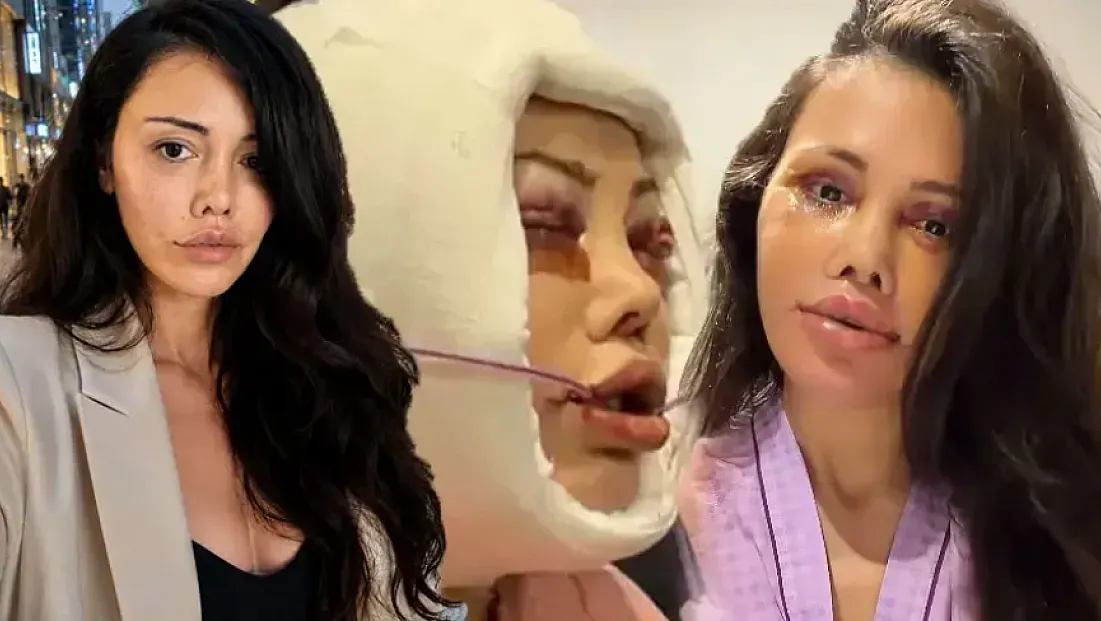 Güney Kore'de 15 saatlik operasyon geçiren Didem Ceran'dan 'ünlü' kıyaslaması