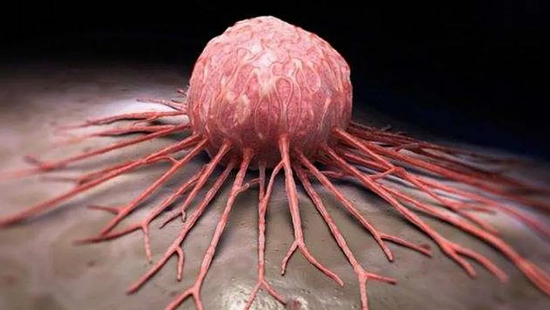 Türkiye’de en yaygın görülen kanser türleri neler?