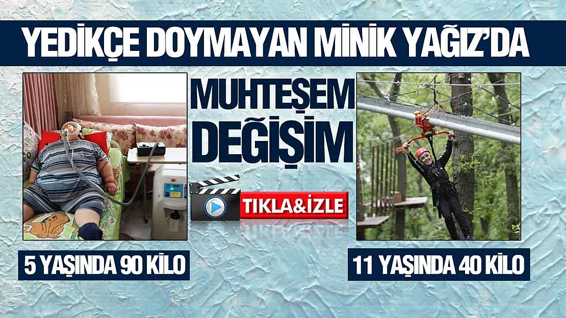 Samsun'da Yağız'ın inanılmaz değişimi, 5 yaşında 90 kiloydu, 11 yaşında 40 kilo