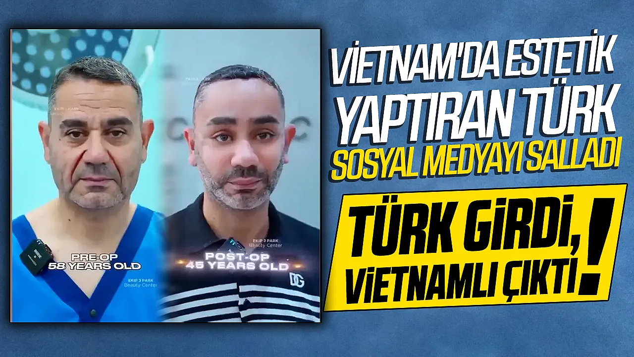 Vietnam'da yüz gençleştirme ameliyatı olan Türk vatandaşının son hali gündem oldu