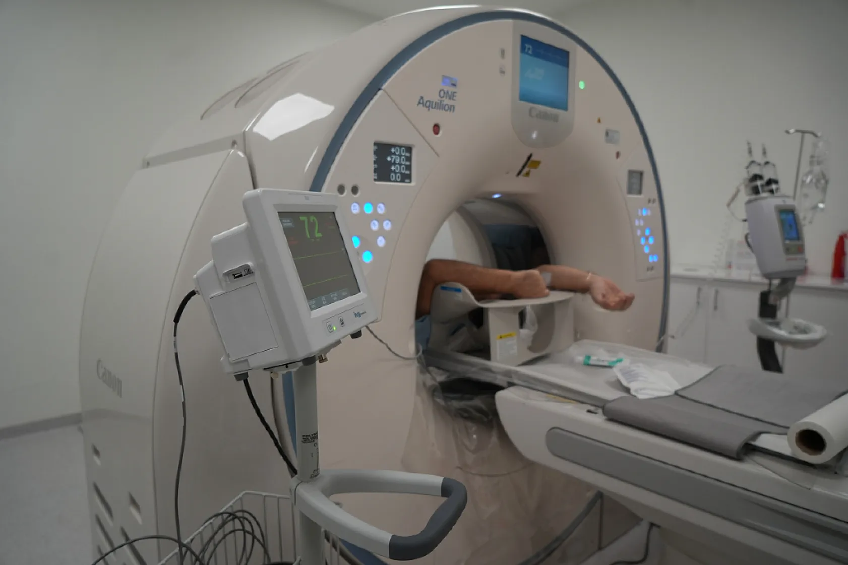Türkiye'de sadece 4 merkezde var: Yapay zekalı tomografi Samsun'da