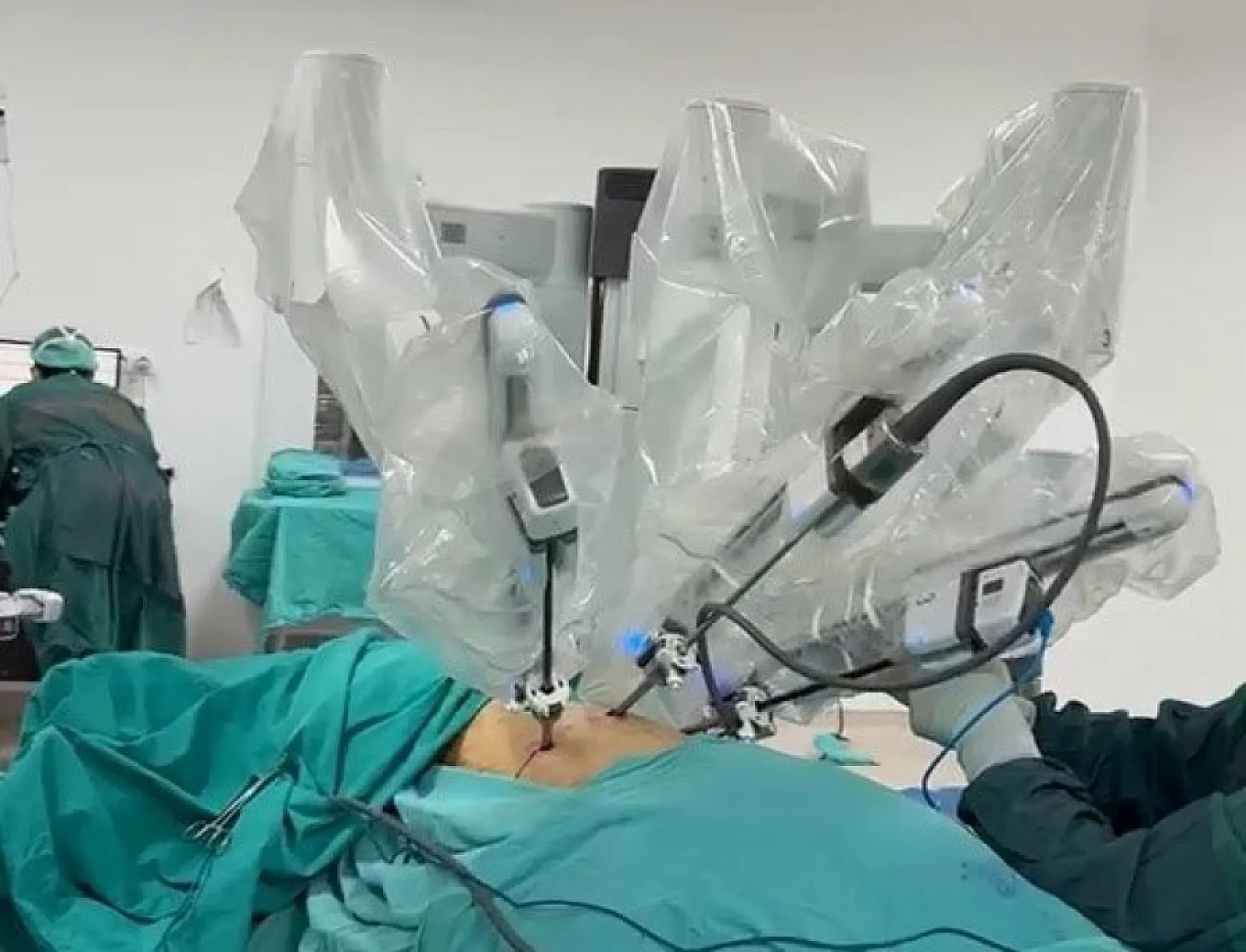 Karadeniz'de bir ilk: OMÜ'de robotik akciğer ameliyatı gerçekleştirildi