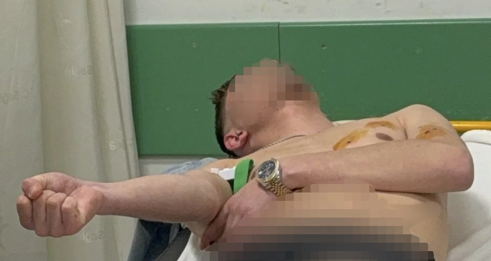 Samsun'da pompalı saldırı: 2 yaralı