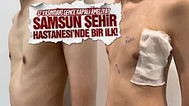 Samsun Şehir Hastanesi'nde bir ilk! 17 yaşındaki gencin göğüs kafesi kapalı ameliyatla düzeltildi