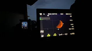 Samsunlu doktorun gökyüzü tutkusu