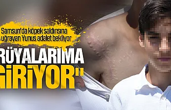Köpek saldırısına uğrayan Yunus adalet bekliyor