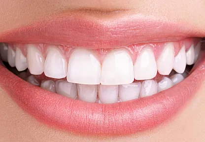 Diş Neden Çürür?