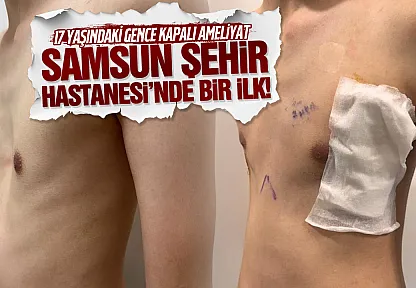 Samsun Şehir Hastanesi'nde bir ilk! 17 yaşındaki gencin göğüs kafesi kapalı ameliyatla düzeltildi