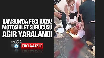 Samsun'da motosiklet ile otomobil çarpıştı:1 ağır yaralı