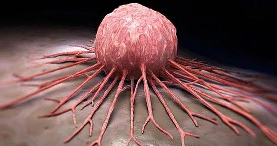 Türkiye'de en yaygın görülen kanser türleri neler?