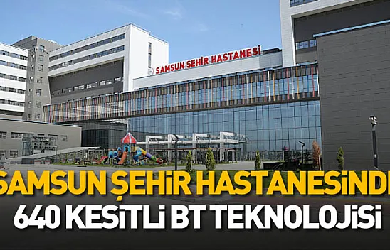 Türkiye'de sadece 4 merkezde var: Yapay zekalı tomografi Samsun'da