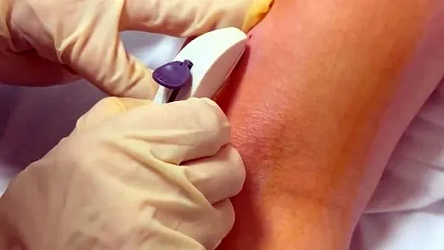 Deri altı implantı ile 3 yıl boyunca konforlu cinsel korunma