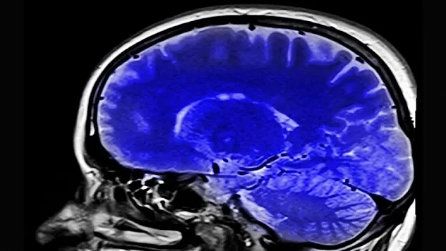Kronik ağrıların beyindeki kaynağını inceleyen araştırma, hastalara umut olabilir