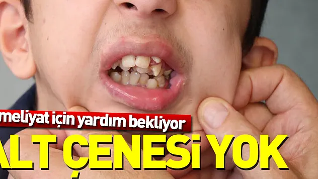 ALT ÇENESi YOK