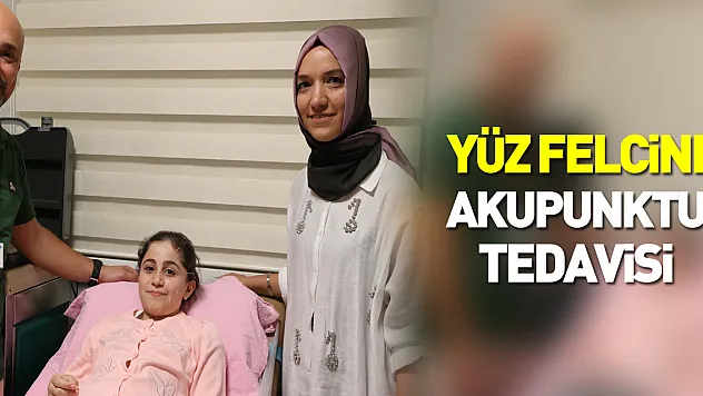 Yüz Felcine Akupunktur Tedavisi