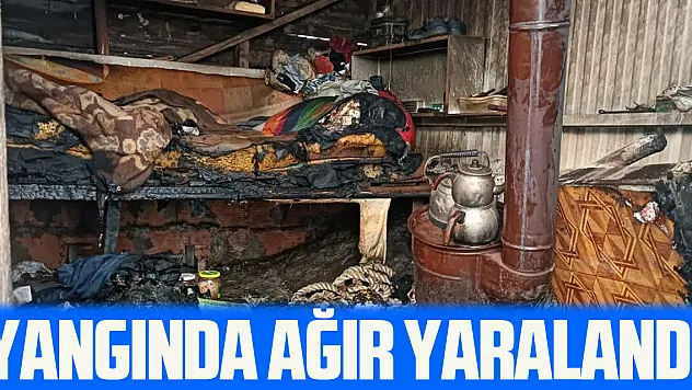 YANGINDA AĞIR YARALANDI