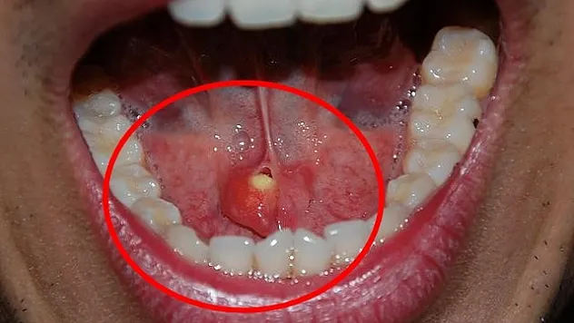 Tehlike Ağızda Gizli