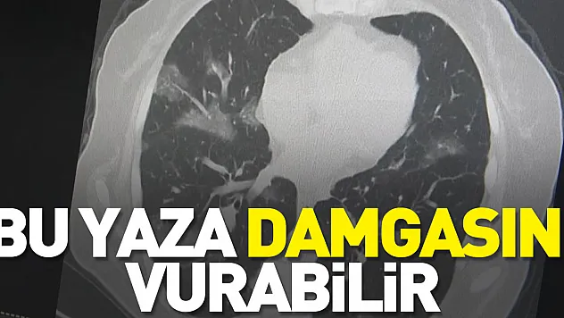 Bu yaza damgasını vurabilir