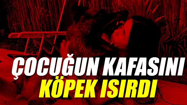 KAFASINI KÖPEK ISIRDI