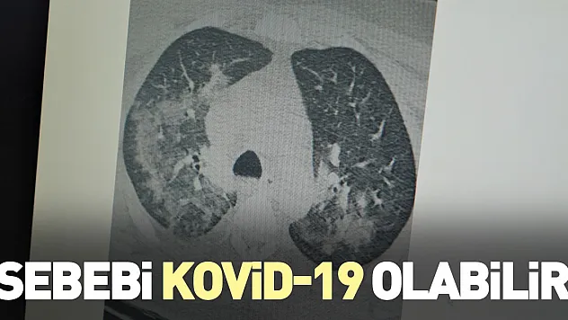 'Sebebi Kovid-19 olabilir'