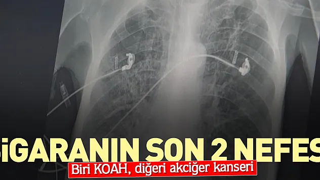 SİGARANIN SON 2 NEFESİ
