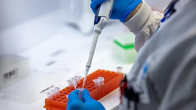 Maymun çiçeği virüsü halk sağlığı acil durumu oluşturuyor