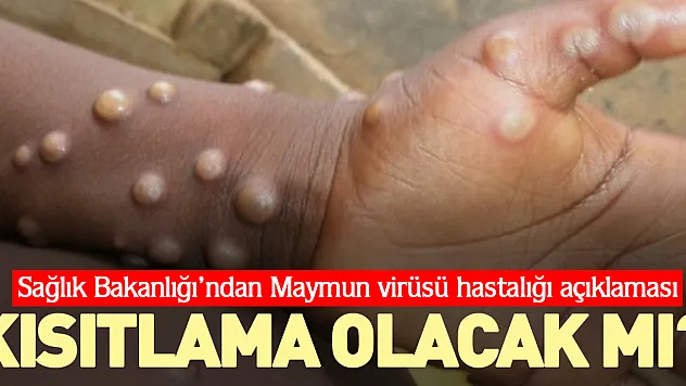 KISITLAMA OLACAK MI?