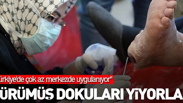 Çürümüş dokuları yiyorlar