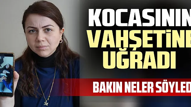 KOCASININ VAHŞETiNE UĞRADI