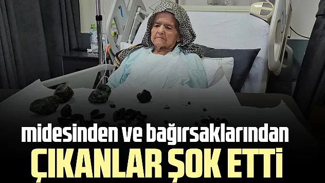 midesinden ve bağırsaklarından çıkanlar şok etti