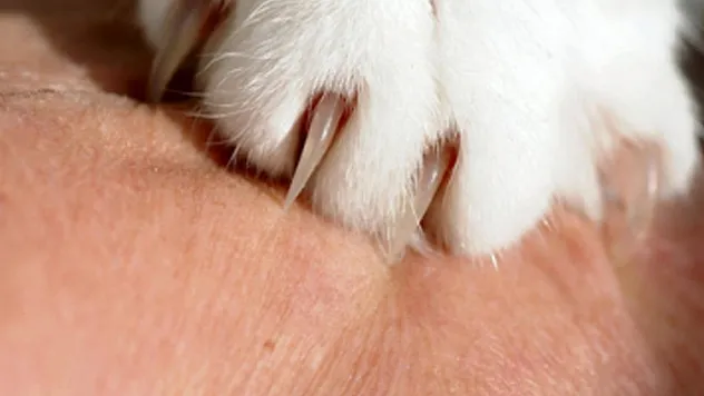 Kedi tırmalamasına dikkat!