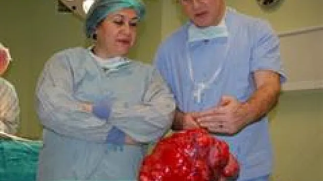 Türkiye'de tespit edilen en büyük rahim myomu