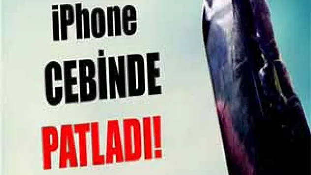 13 yaşındaki kızın iPhone'u cebinde patladı