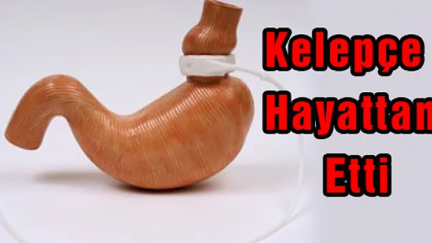 MİDESİNE KELEPÇE TAKTIRAN KADIN HAYATINI KAYBETTİ