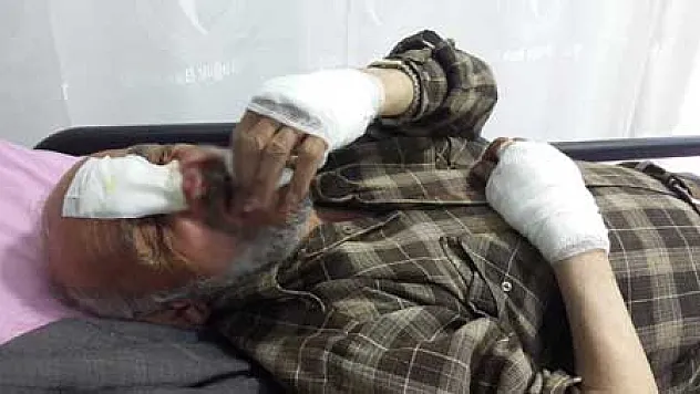 MOTOSİKLETTEN DÜŞEN YAŞLI ADAM HASTANELİK OLDU