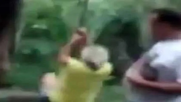 Kızını kırmak istemeyince kemiklerini kırdı!