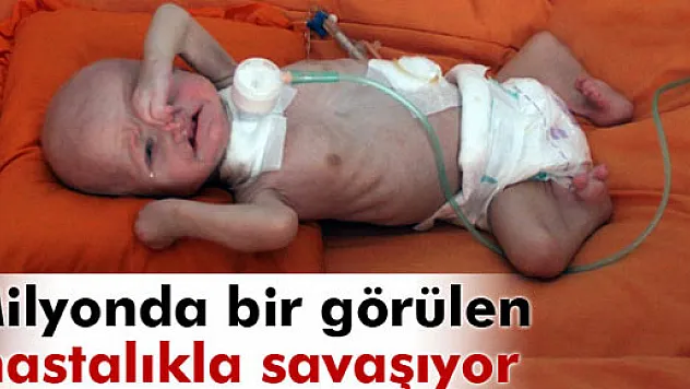 Minik Mustafa milyonda bir görülen hastalıkla savaşıyor