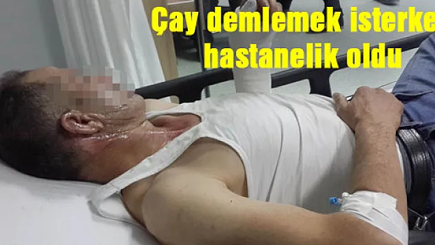 Çay demlemek isterken hastanelik oldu