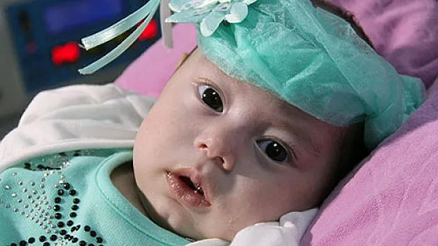 Dört aylık bebek 'doku yapıştırıcısıyla' hayata tutundu