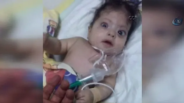 Domuz gribi teşhisi konulan bebek başka bebeklerle aynı yatakta