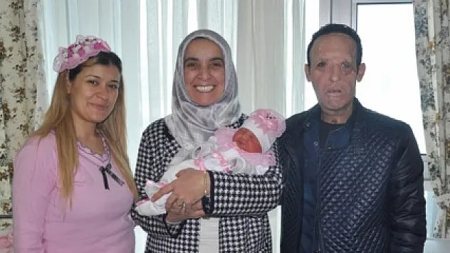 Yüz nakli olan Recep Sert'in babalık sevinci