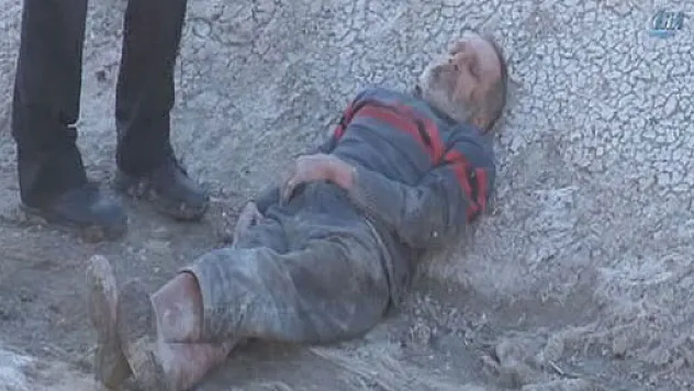 Yaşlı adam 1 hafta boyunca saçlarını yiyerek beslendi