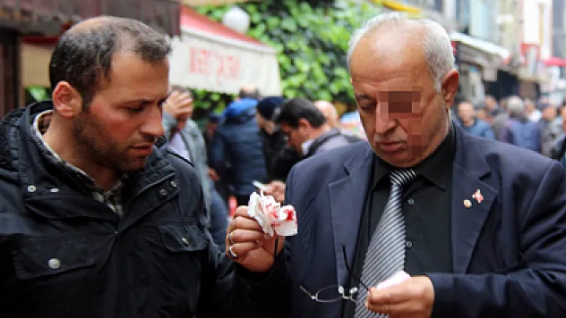 Yumruklu Saldırı: 1 Yaralı