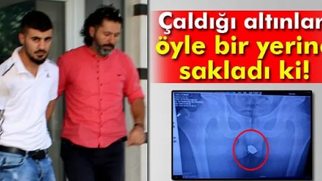 Çaldığı ziynet eşyaları röntgende ortaya çıktı