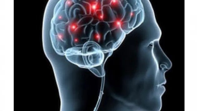 Beyin damar tedavisinde altın yöntem